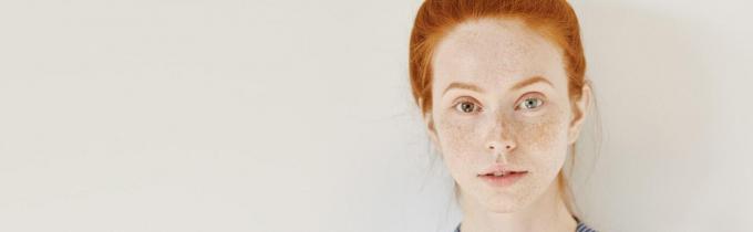 Job: London. {PAID} Looking for Female Models with Visible Freckles (Ages 18-35) for Photo Shoot